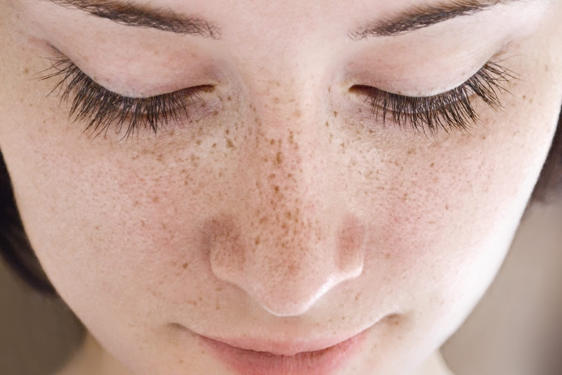 そばかすのある女性の顔