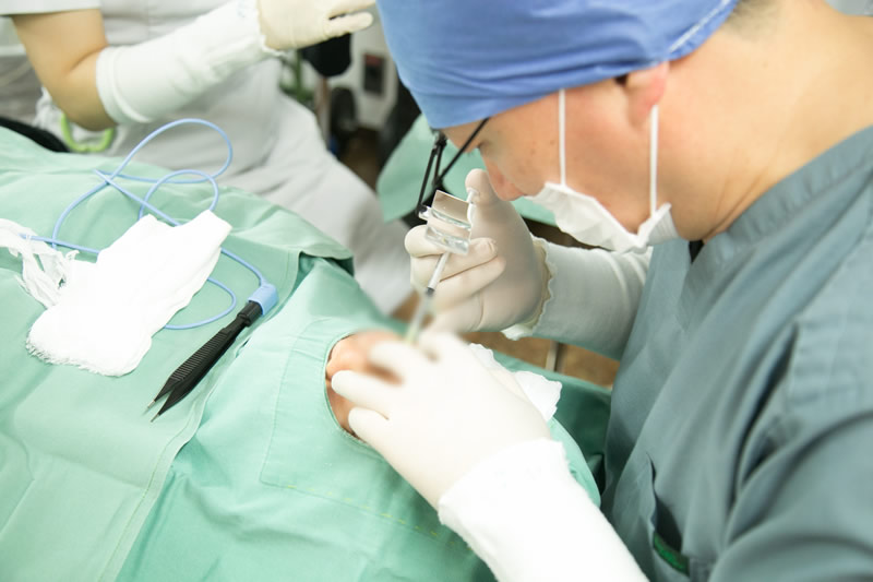 眼瞼下垂の手術をする医師