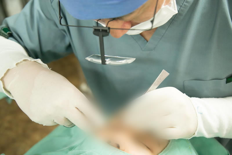 眼瞼下垂の手術をする美容外科医
