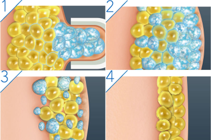 よくある副作用