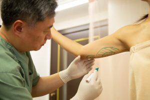 二の腕の脂肪を確認する医師