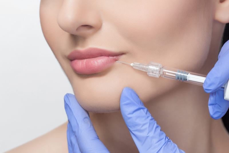 唇にヒアルロン酸を注入しているところ