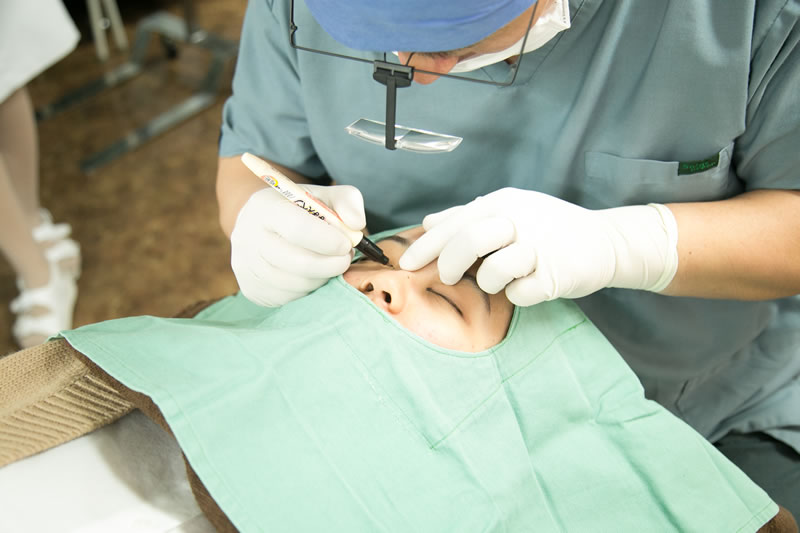 眼瞼下垂の手術をしている医師