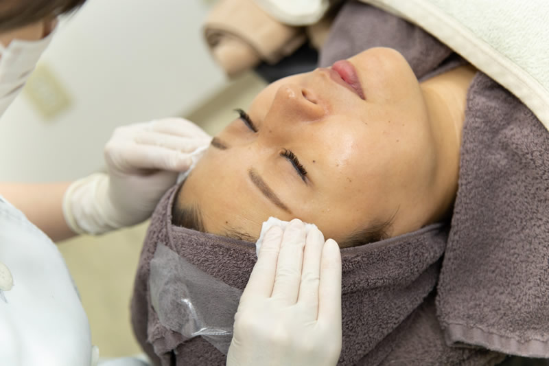 美容外科でニキビ治療を受ける患者
