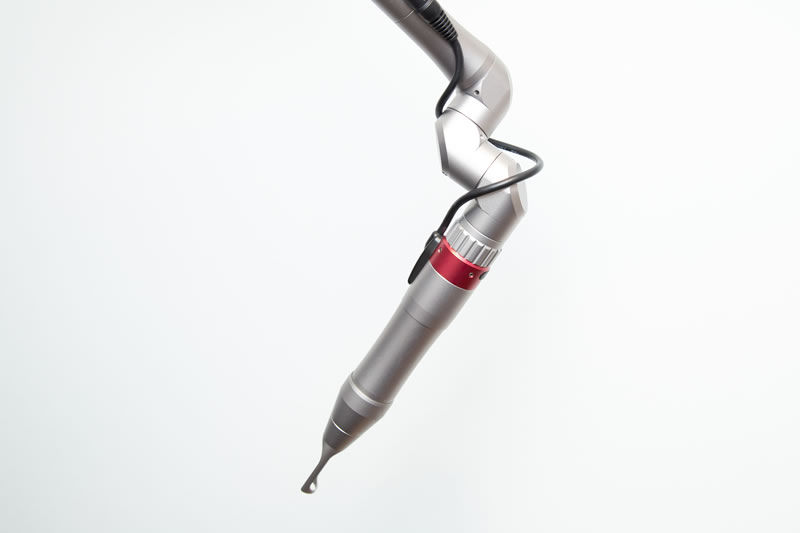 シミ治療のレーザー