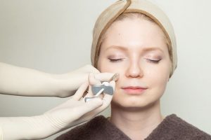 シワにヒアルロン酸を注入されている女性