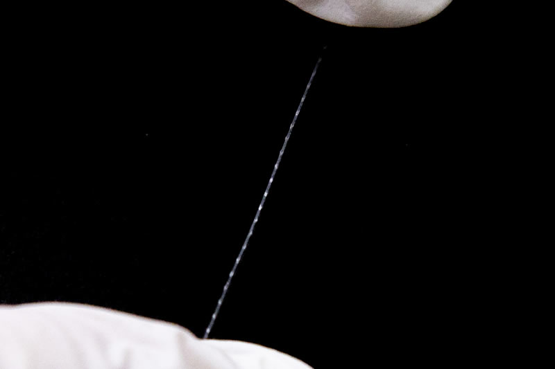 糸リフトを両端から摘んでいる様子