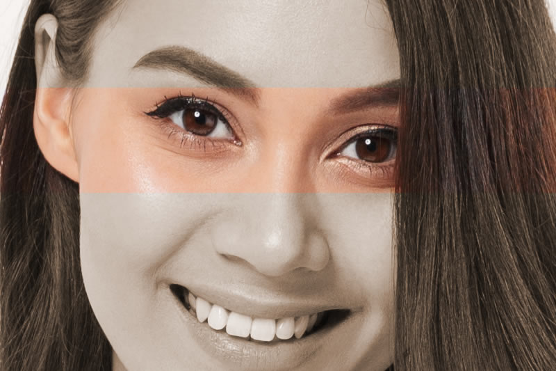 まぶたが重いのはなぜ 原因と解決方法をご紹介 共立美容外科