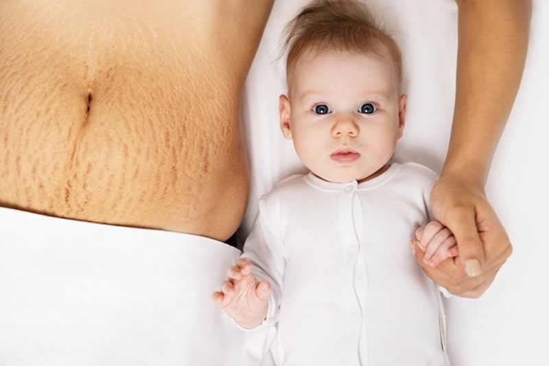 妊娠線と赤ちゃん