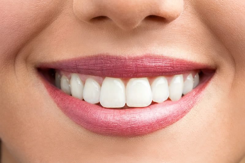 出っ歯は自力で直せる？4つの治療方法を紹介！