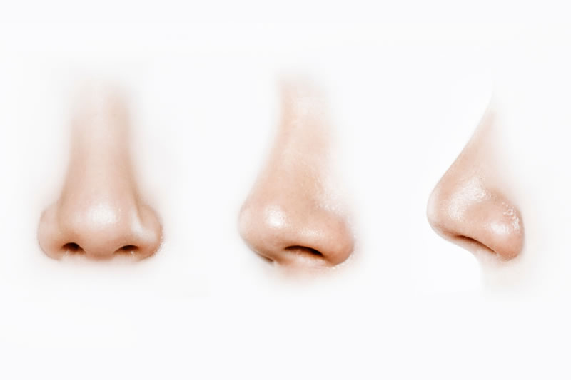 鼻整形で鼻の悩みを解消しよう！施術の種類やダウンタイムをご紹介