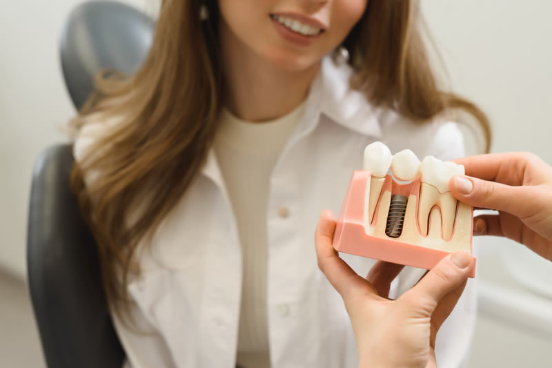 インプラント治療が上手い名医と歯科医院の選び方５つのポイント
