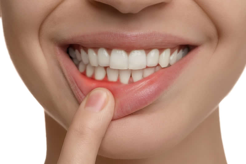 歯周病の治療方法とは？治療の基本の流れや正しいセルフケアの方法について解説