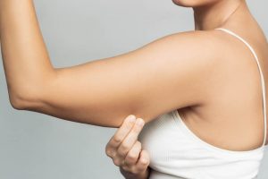 二の腕をつまむ女性