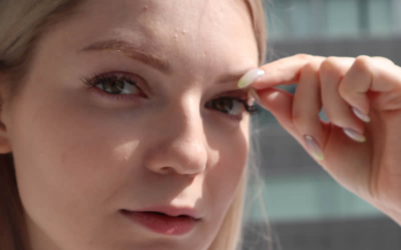 霰粒腫またはものもらい(麦粒腫)