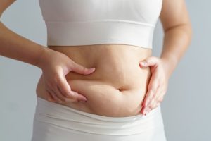 脂肪吸引が気になっている女性