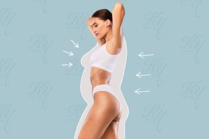 脂肪吸引でスリムになった女性