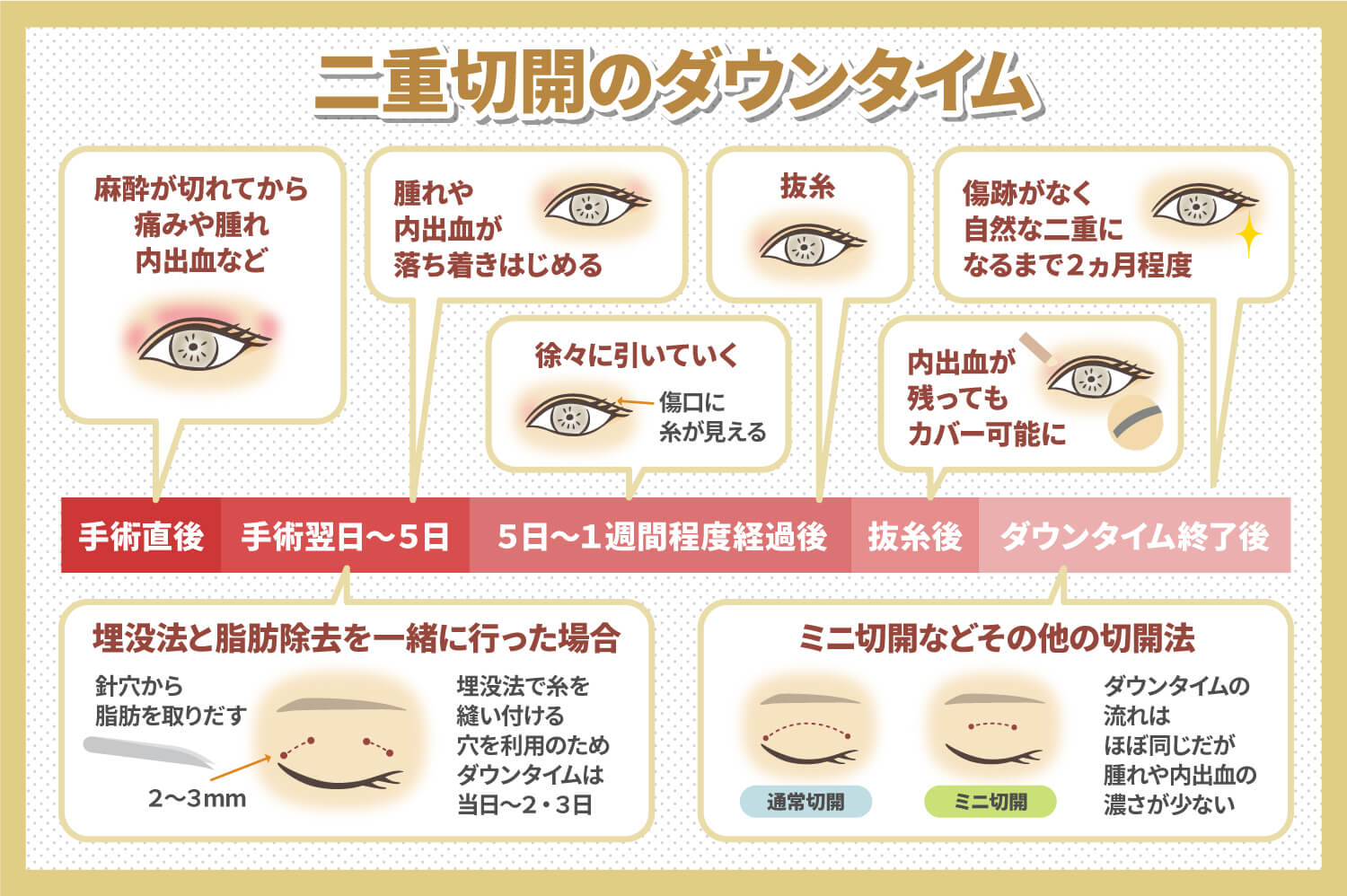 二 重 ダウン タイム