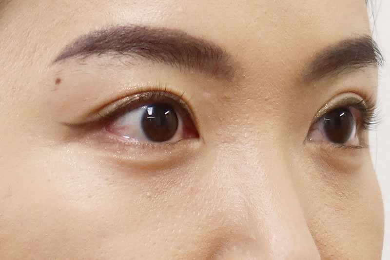 二重が定着した女性の目