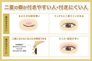 二重の癖が付きやすい人・付きにくい人