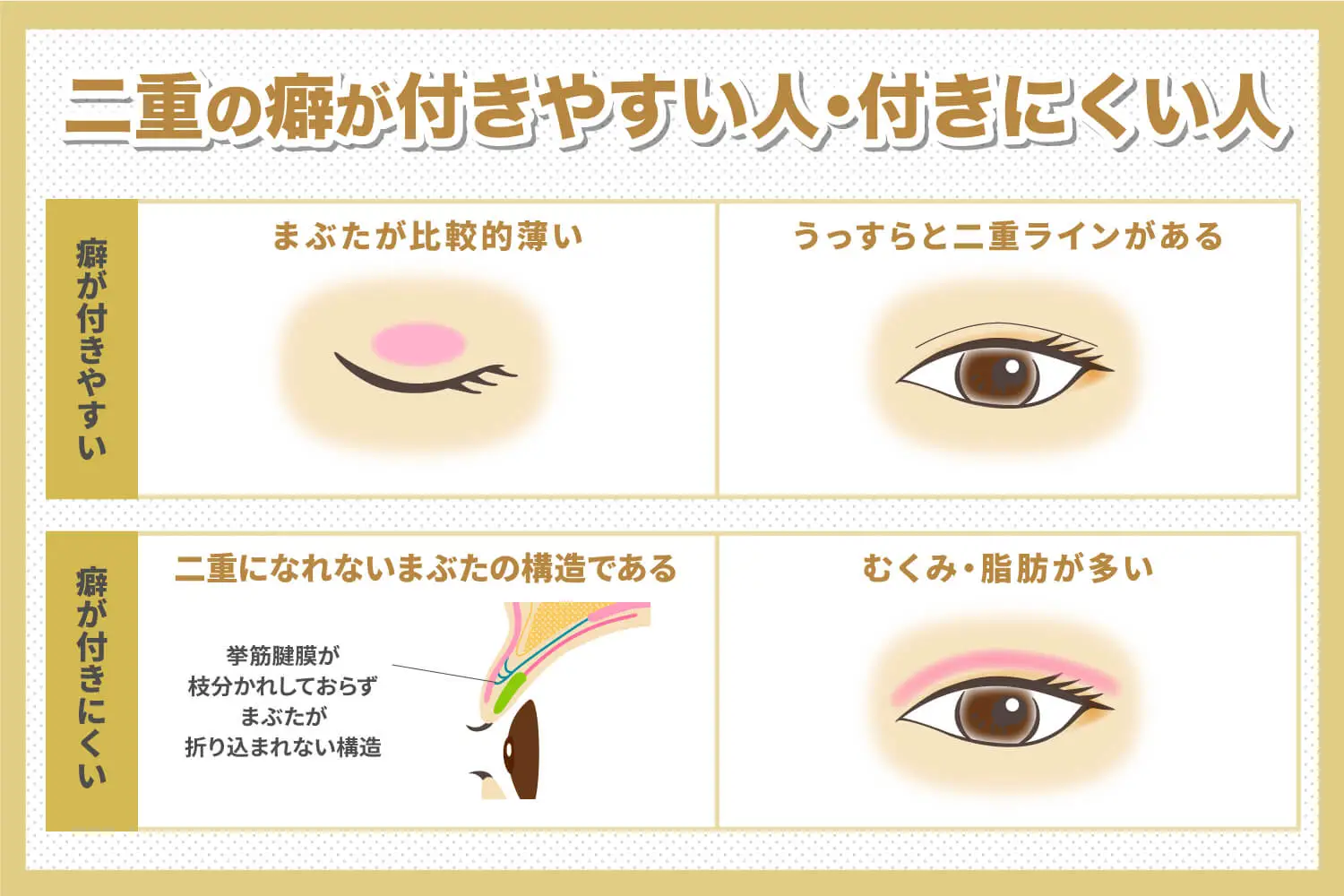 【医師監修】二重の癖を付ければ自然な二重まぶたになる？