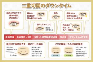 二重切開のダウンタイム