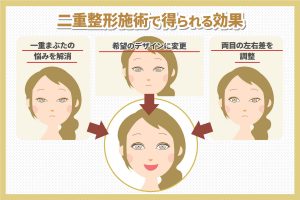 二重整形施術で得られる効果