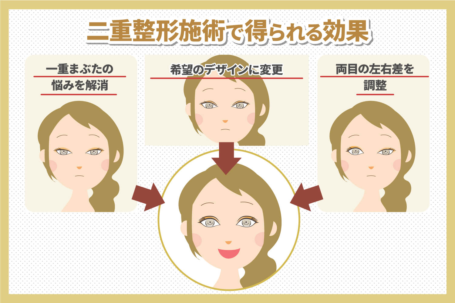 二重整形に種類はあるの?施術別解説
