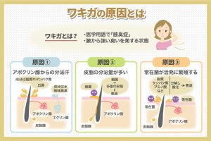 ワキガの原因とは