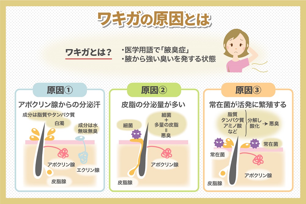 ワキガの原因は汗・皮脂・細菌|今日できる6つの対策と治療の選び方