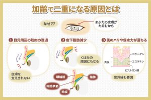 加齢で二重になる原因とは