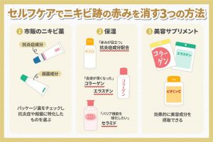 セルフケアでニキビ跡の赤みを消す3つの方法