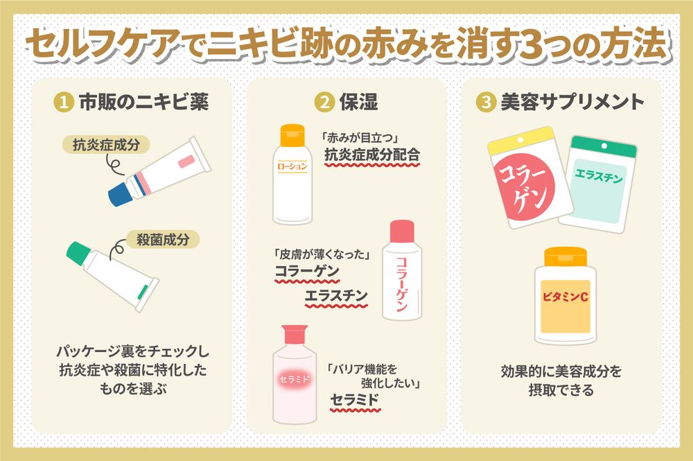 ニキビ跡の赤みは消える?自宅でできることと、クリニックの治療