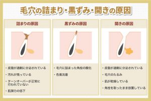 毛穴の詰まり・黒ずみ・開きの原因