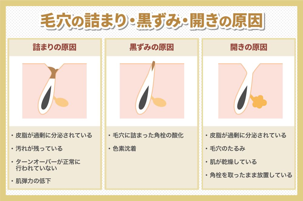 毛穴の詰まりや黒ずみ、開きはどうやってケアすればいいの?