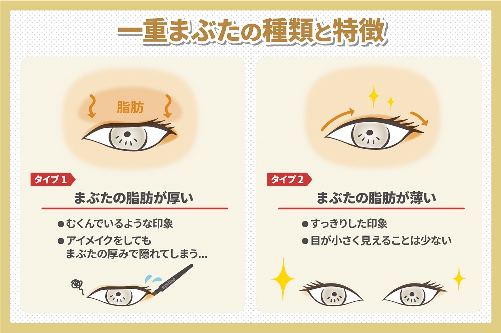 一重まぶたの種類と特徴