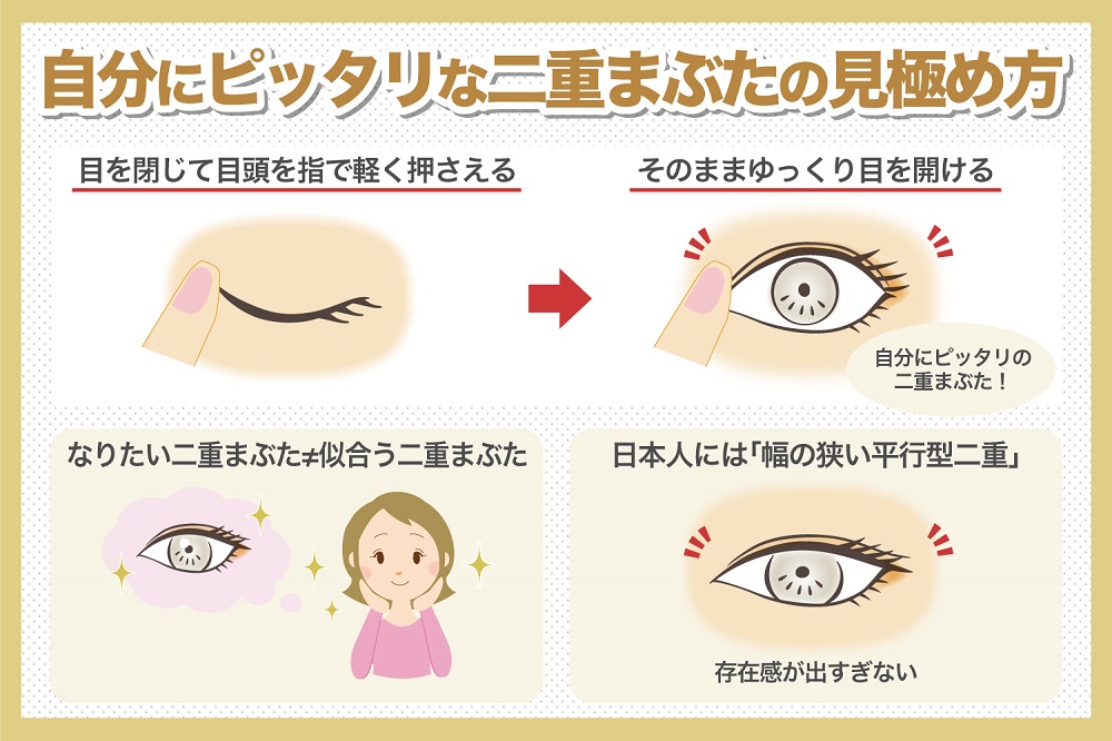 まぶたの種類別、なりたい二重を手に入れる方法