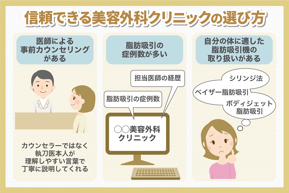 脂肪吸引で失敗することがあるって本当?ありがちな失敗と信頼できるクリニック選びのポイントを解説