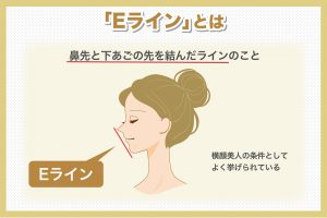 Eラインとは