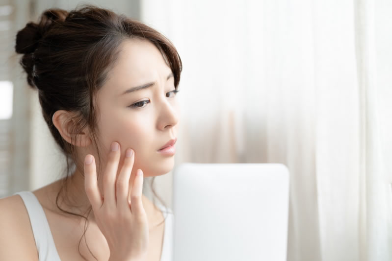 ニキビを気にする女性