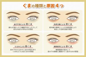 くまの種類と原因4つ