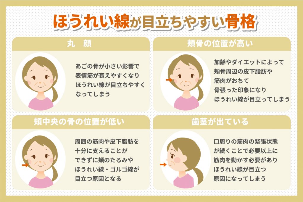 ほうれい線が目立ちやすい骨格