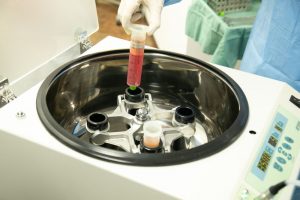 遠心分離器に脂肪を入れる医師