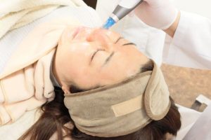 ダーマペンの毛穴治療をしている様子
