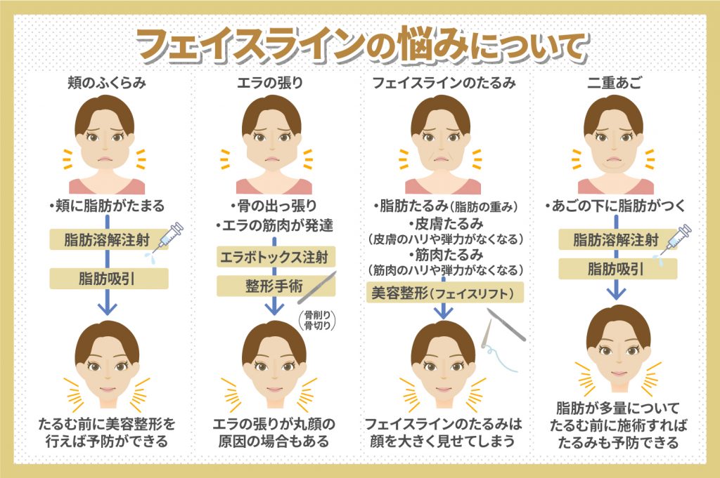 フェイスラインの悩みについて