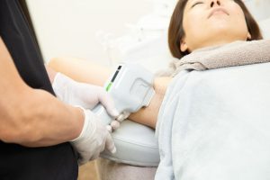 ミラドライを当てているところ