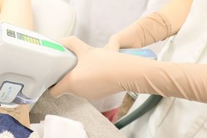 ミラドライを脇に照射している