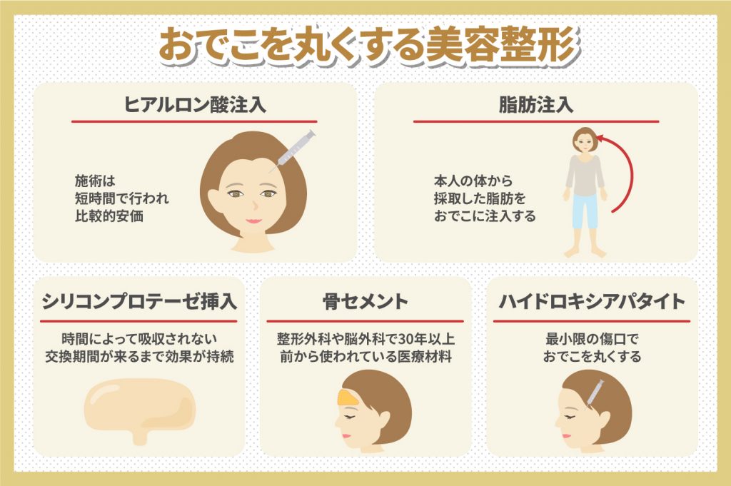 おでこを丸くする美容整形
