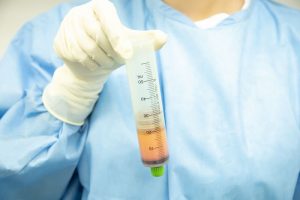 採取した脂肪を持っている医師