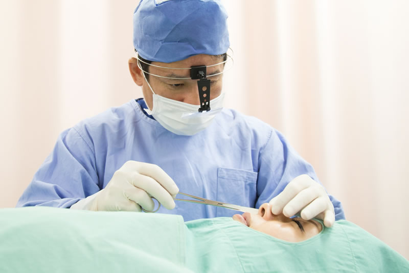 鼻にプロテーゼを挿入する美容外科医師